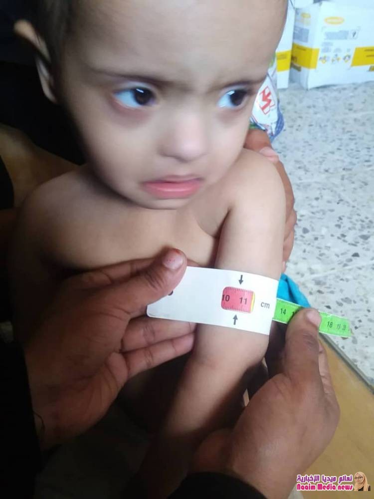 السلطة المحلية بمديرية ماوية تدشن العمل بالوحدة الصحيةلعزلة حوامرة