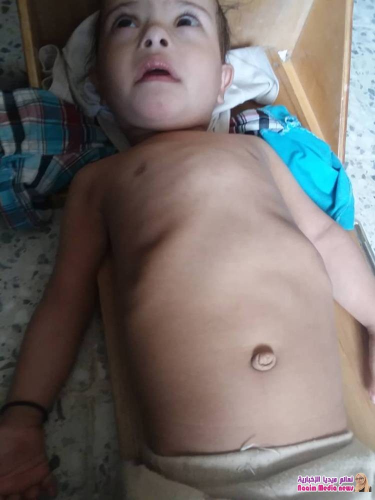 السلطة المحلية بمديرية ماوية تدشن العمل بالوحدة الصحيةلعزلة حوامرة