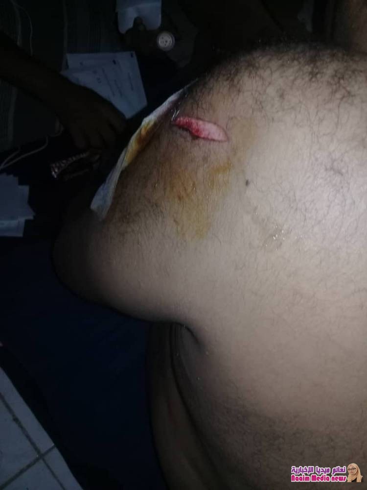 محاولة اغتيال فاشلة لضابطين في امن العاصمة عدن ادى الى اصابة احدهم 