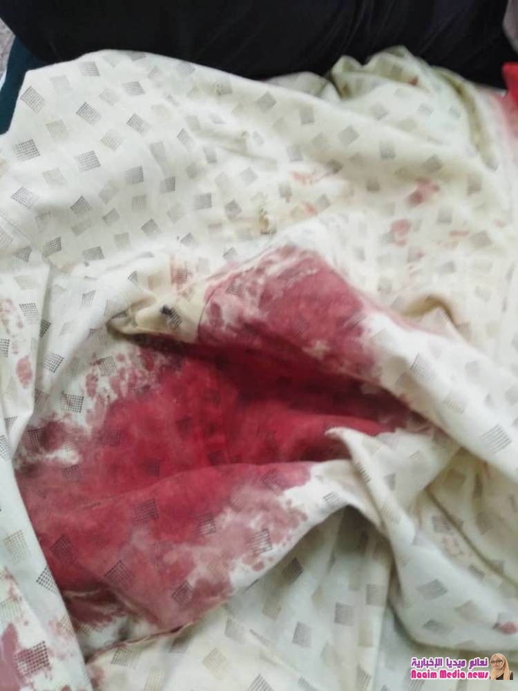 محاولة اغتيال فاشلة لضابطين في امن العاصمة عدن ادى الى اصابة احدهم 