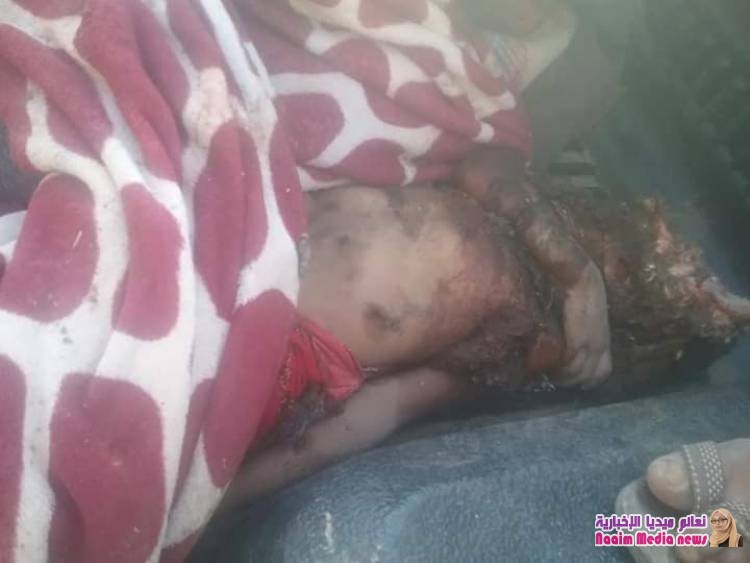 مدير عام مديرية جبل حبشي يدين قصف المليشيات الحوثية للمناطق الآهلة بالسكان بالمديرية ويطالب المجتمع الدولي بمعاقبتها والإنتصار لحال المدنيين.