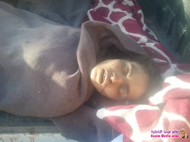 مدير عام مديرية جبل حبشي يدين قصف المليشيات الحوثية للمناطق الآهلة بالسكان بالمديرية ويطالب المجتمع الدولي بمعاقبتها والإنتصار لحال المدنيين.