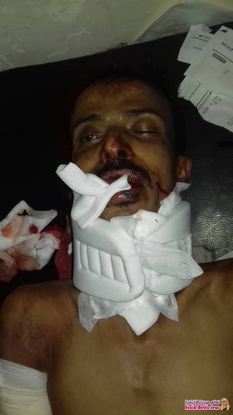 احدى نتائج ممارسة جرائم الحوثي بزرع الالغام