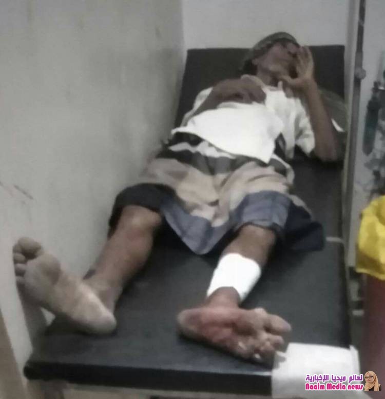 احدى نتائج ممارسة جرائم الحوثي بزرع الالغام