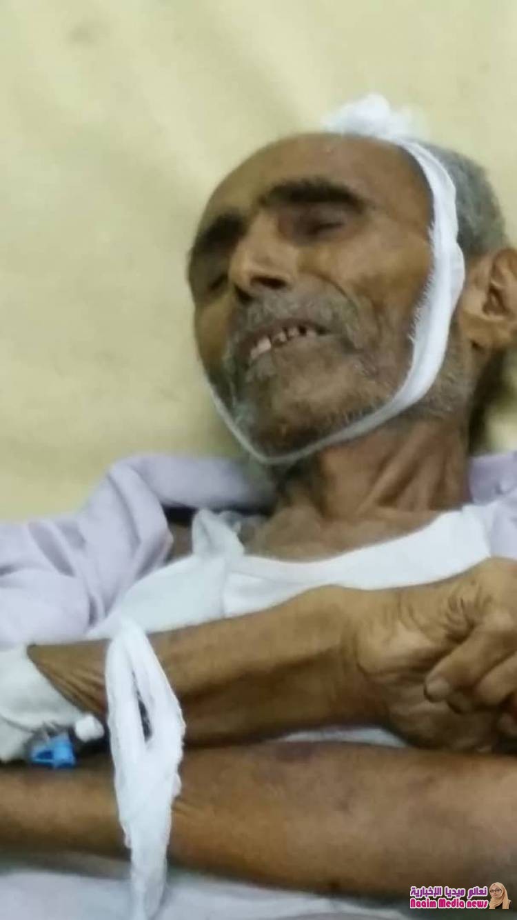 انشىوها للمساعده