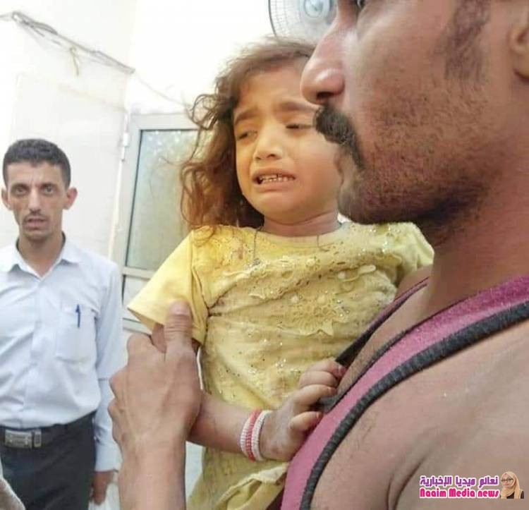 سقوط قذيفة لمليشيا الحوثي الى حارة الجشاش بوادي القاضي