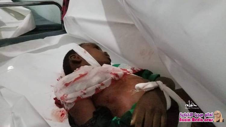 تعز : مجزرة بشعة ترتكبها مليشيا الحوثي الانقلابية بحق تجمع للمدنيين 