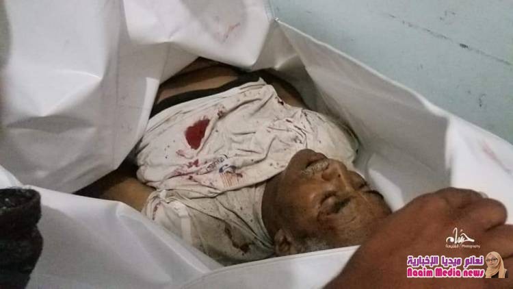 تعز : مجزرة بشعة ترتكبها مليشيا الحوثي الانقلابية بحق تجمع للمدنيين 