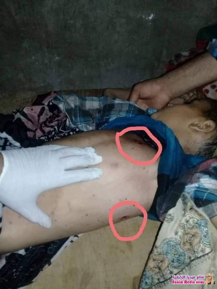 إصابة الطفل شاكر رشدي