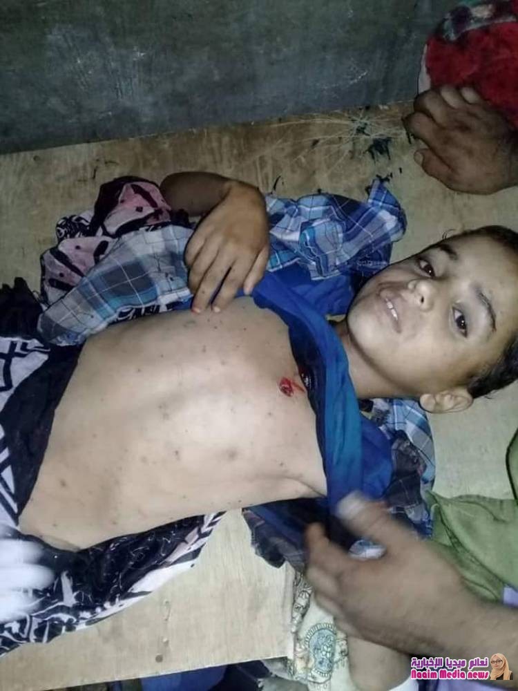 إصابة الطفل شاكر رشدي