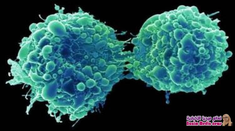 سرطان المثانة: فيروس زكام شائع "يقتل الخلايا الخبيثة ويمنع عودتها"