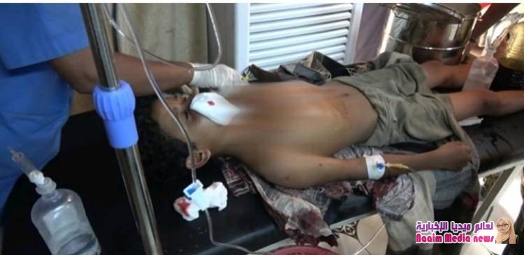 قصفت مليشيات الحوثي حي منظر التابع لمديرية الحوك جنوب مدينة الحديدة بالقذائف المدفعية مستهدفة الأحياء السكنية . 