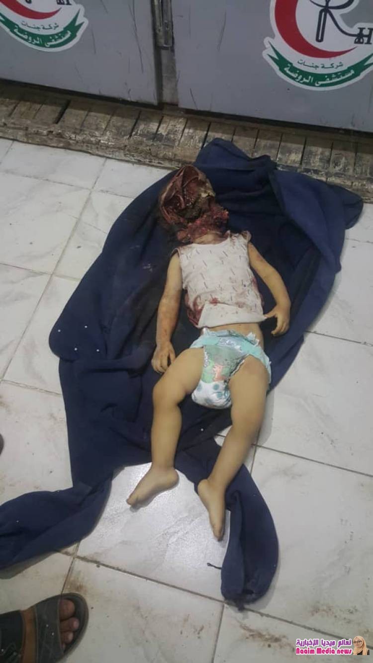 استشهاد طفل وإصابة طفلتين إحداهما بجروح خطرة،