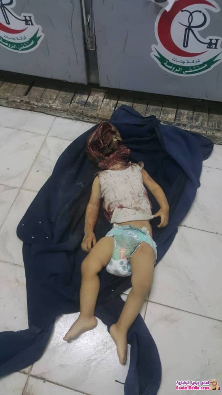 استشهاد طفل وإصابة طفلتين إحداهما بجروح خطرة،