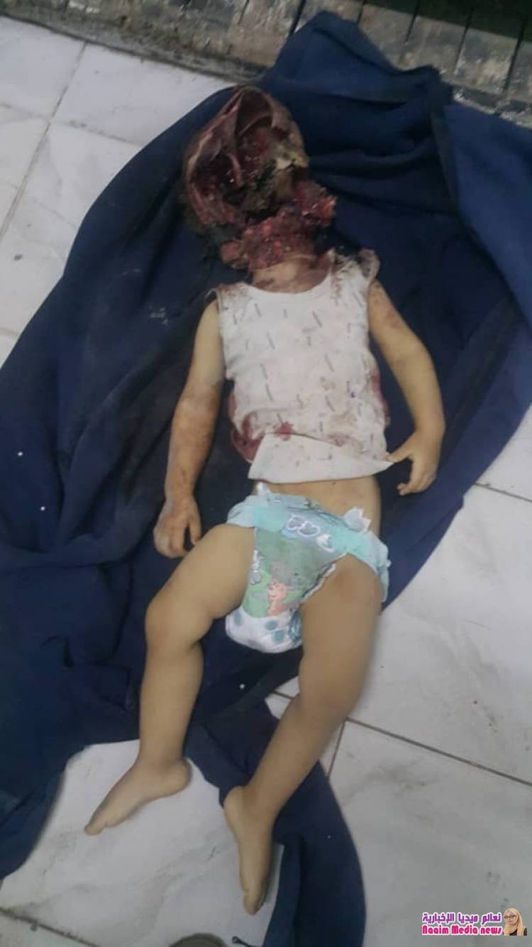 استشهاد طفل وإصابة طفلتين إحداهما بجروح خطرة،