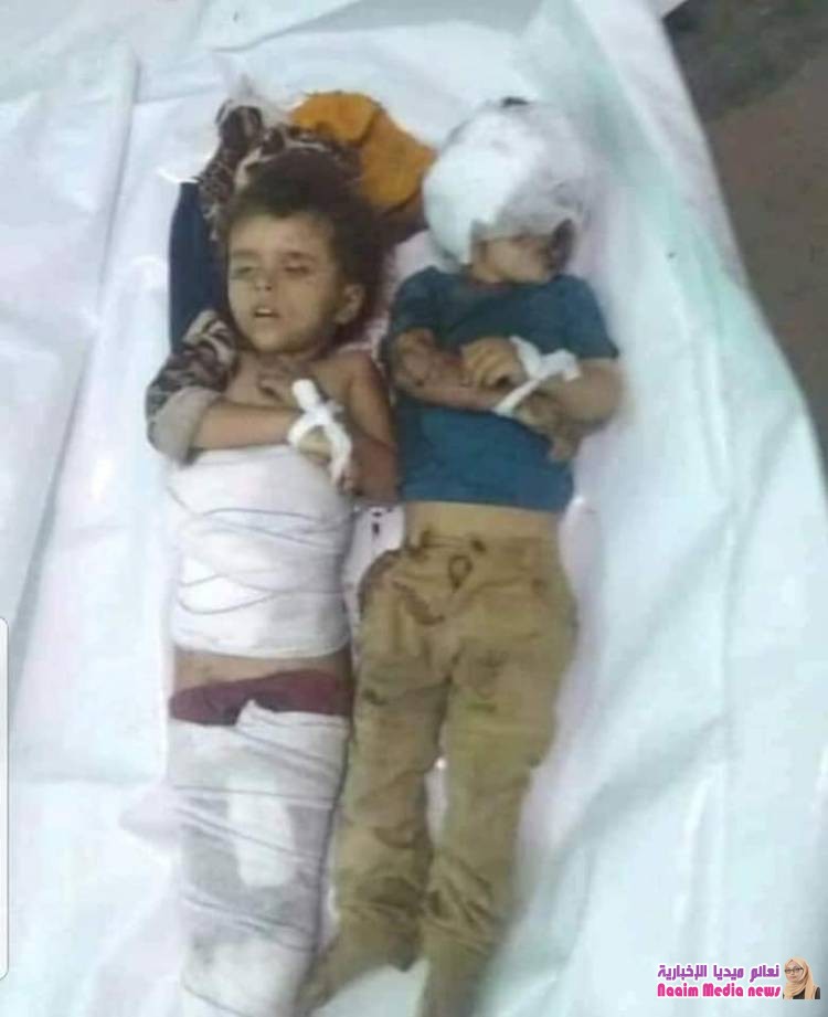 استشهاد طفلين وإصابة ثالث في انفجار لغم زرعه الحوثيون