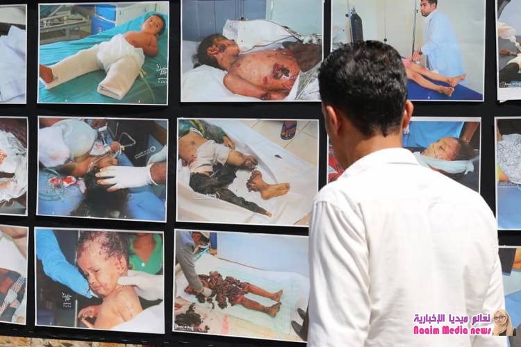 تعز : الحملة الوطنية لاستعادة الدولة ، تقيم معرض صور لتجسيد انتهاكات مليشيا الحوثي