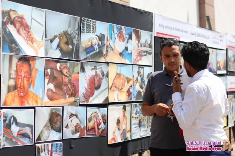 تعز : الحملة الوطنية لاستعادة الدولة ، تقيم معرض صور لتجسيد انتهاكات مليشيا الحوثي