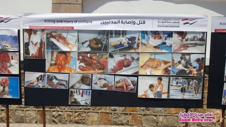 تعز : الحملة الوطنية لاستعادة الدولة ، تقيم معرض صور لتجسيد انتهاكات مليشيا الحوثي