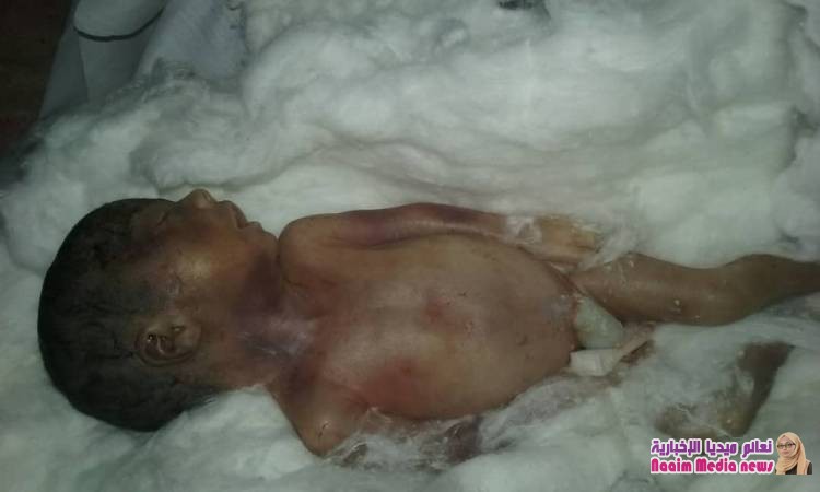 ابشع الجرائم الا انسانيه في تعز