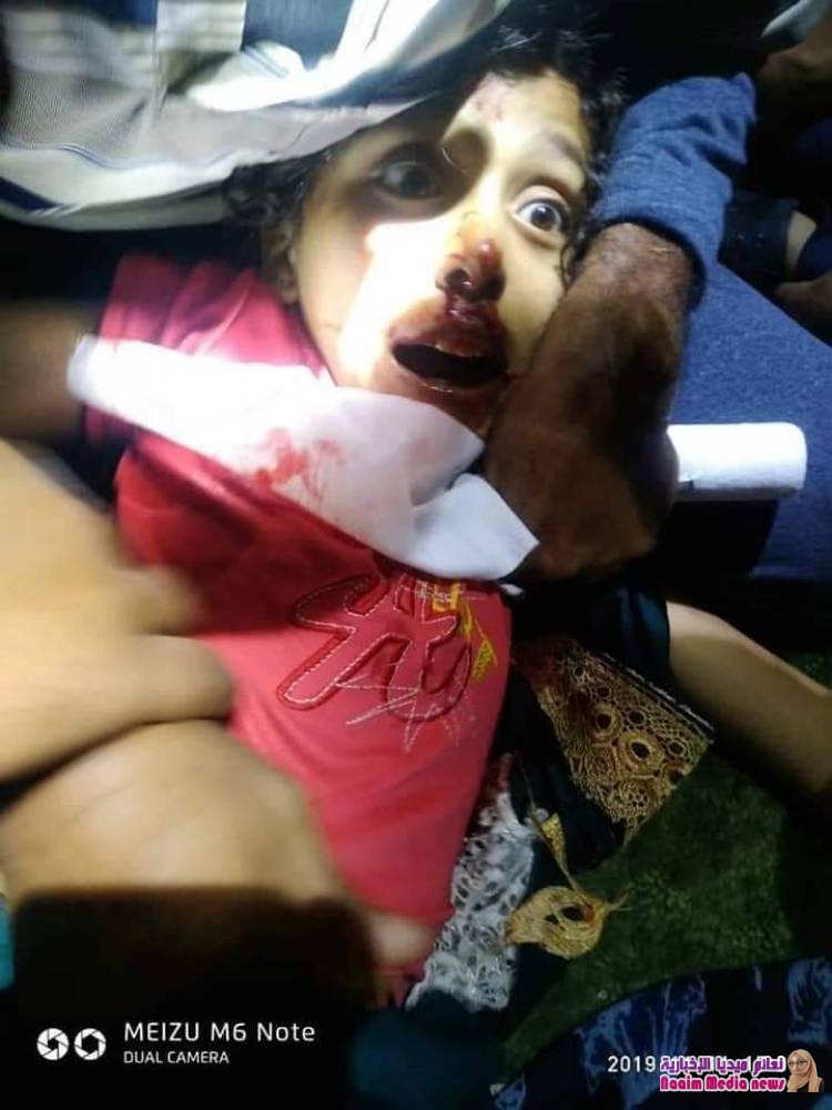 خلال ٢٤ ساعة استشهاد وإصابة 4 أطفال بقصف إرهابي لمليشيات الحوثي بالصلو جنوب تعز