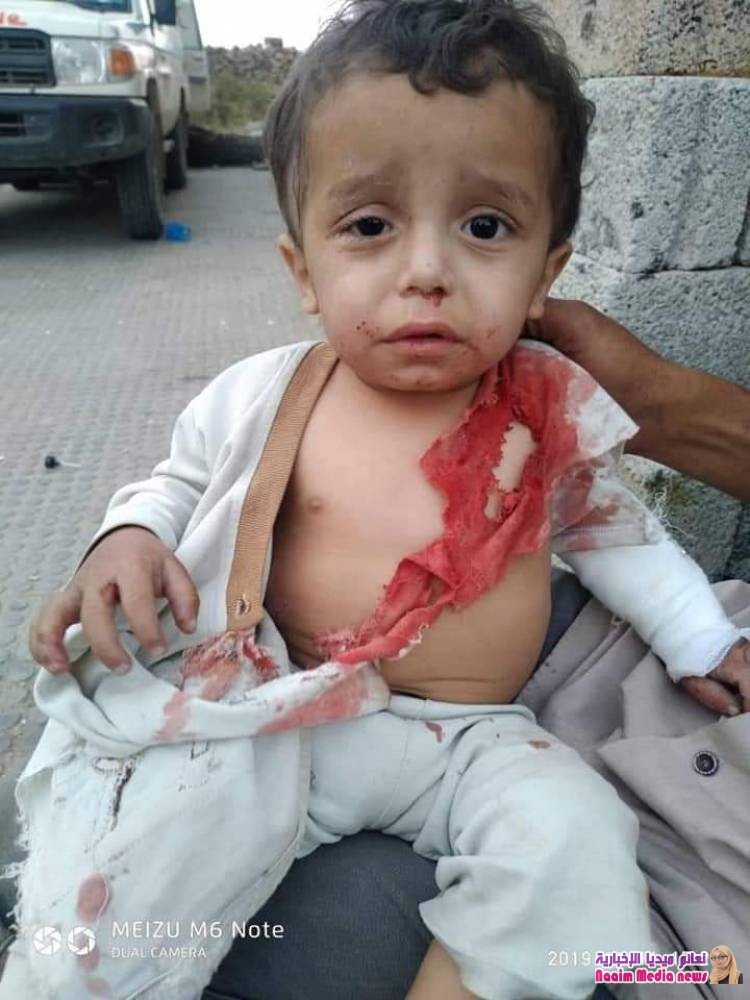 خلال ٢٤ ساعة استشهاد وإصابة 4 أطفال بقصف إرهابي لمليشيات الحوثي بالصلو جنوب تعز