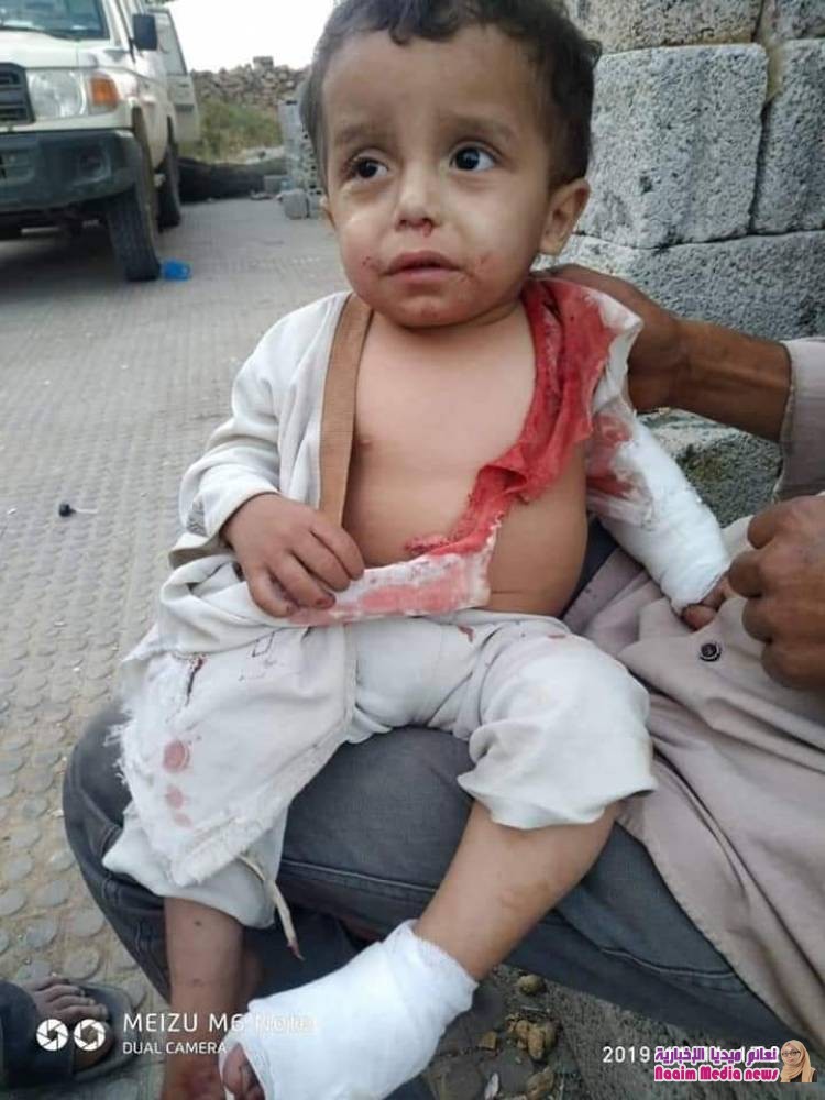 خلال ٢٤ ساعة استشهاد وإصابة 4 أطفال بقصف إرهابي لمليشيات الحوثي بالصلو جنوب تعز