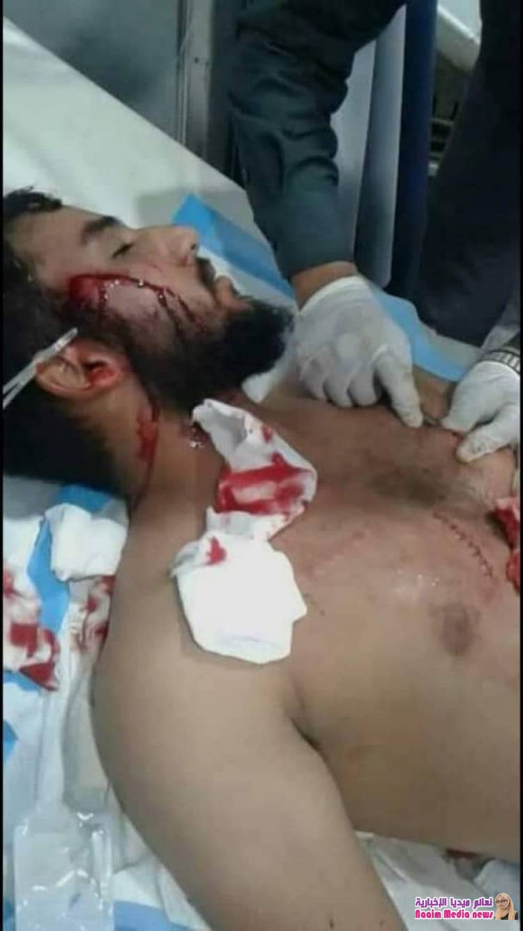 عصابة مشكلة من النساء ترتكب جريمة بشعة بعدن (تفاصيل)