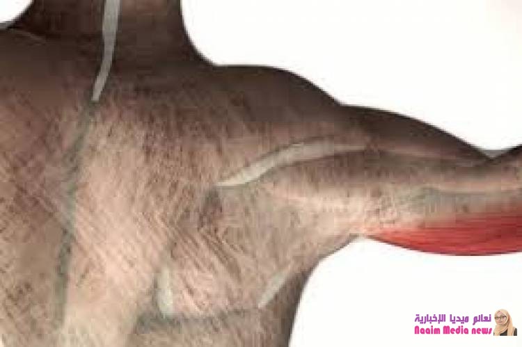 تصلب اللفافة .. التعريف والأعراض والعلاج