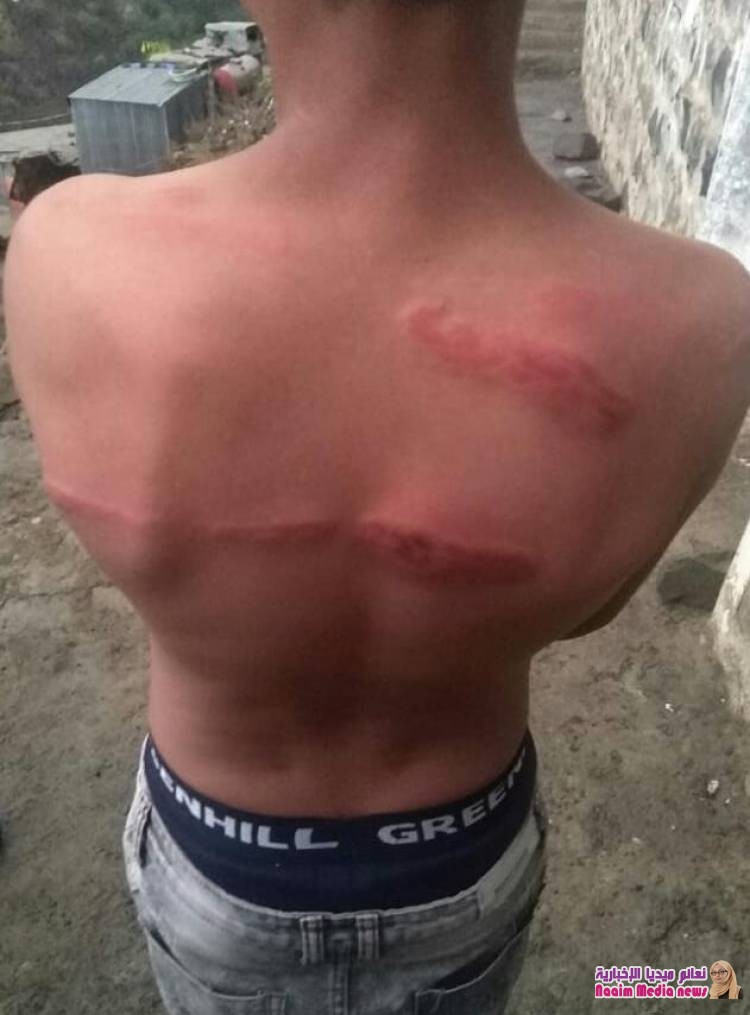 تعز: شيخ قبلي يعتدي بالضرب الجسدي المبرح على طفل في عمر 11 سنه.