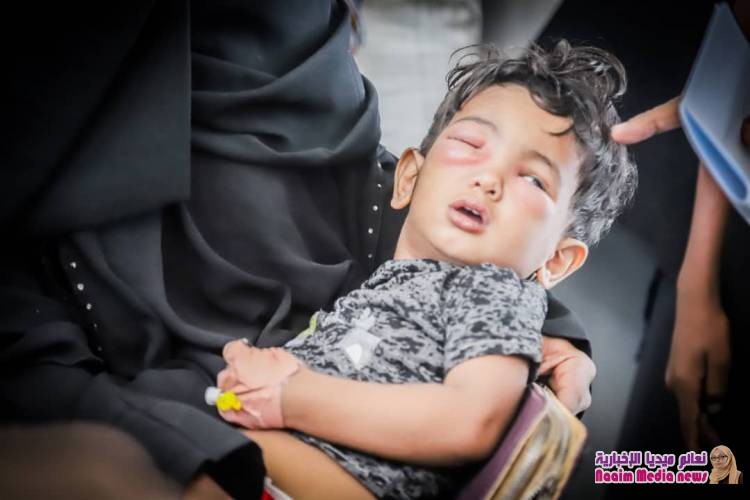 صور تتحدث عن مخيم بصر في حضرموت شحر