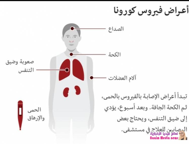 فيروس كورونا: ما أعراضه وكيف تقي نفسك منه؟