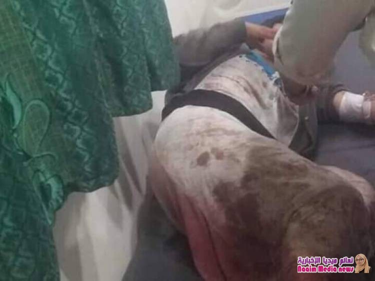 *قتلى وجرحى جراء مجزرة مروعة إرتكبتها المليشيات الحوثية بحق نزيلات السجن المركزي بتعز*
