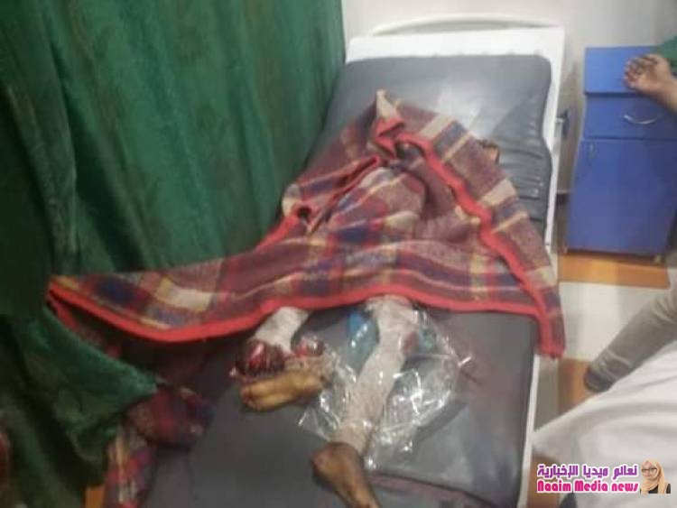 *قتلى وجرحى جراء مجزرة مروعة إرتكبتها المليشيات الحوثية بحق نزيلات السجن المركزي بتعز*