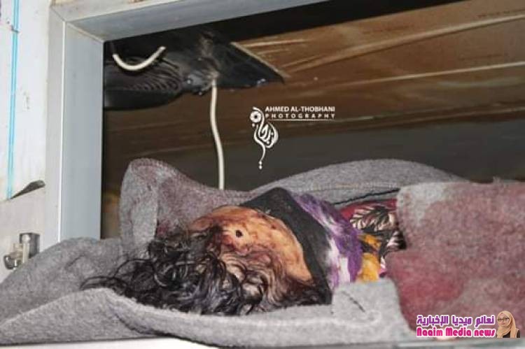 *قتلى وجرحى جراء مجزرة مروعة إرتكبتها المليشيات الحوثية بحق نزيلات السجن المركزي بتعز*