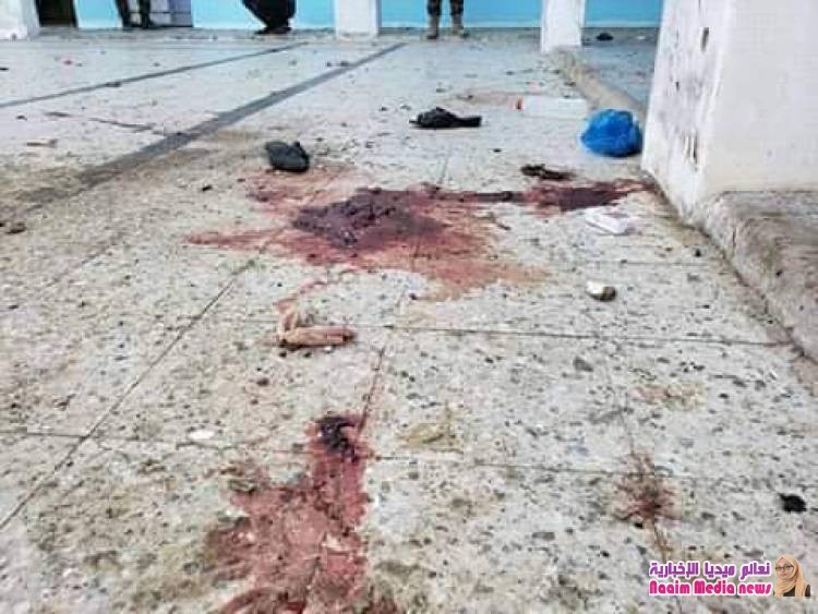 *قتلى وجرحى جراء مجزرة مروعة إرتكبتها المليشيات الحوثية بحق نزيلات السجن المركزي بتعز*