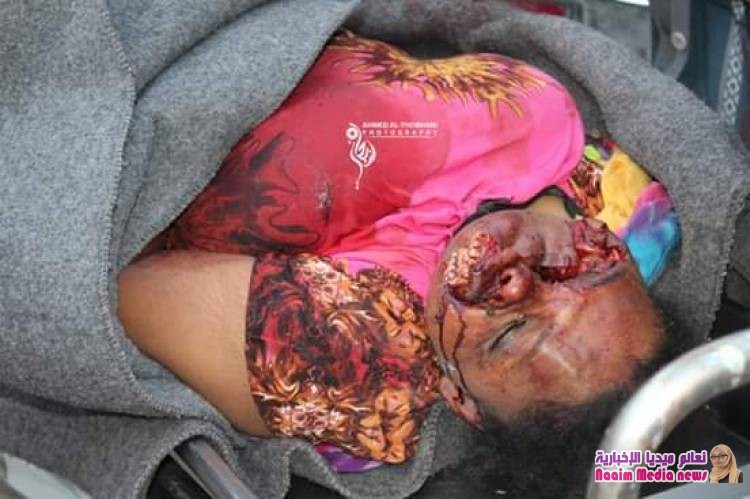 *قتلى وجرحى جراء مجزرة مروعة إرتكبتها المليشيات الحوثية بحق نزيلات السجن المركزي بتعز*