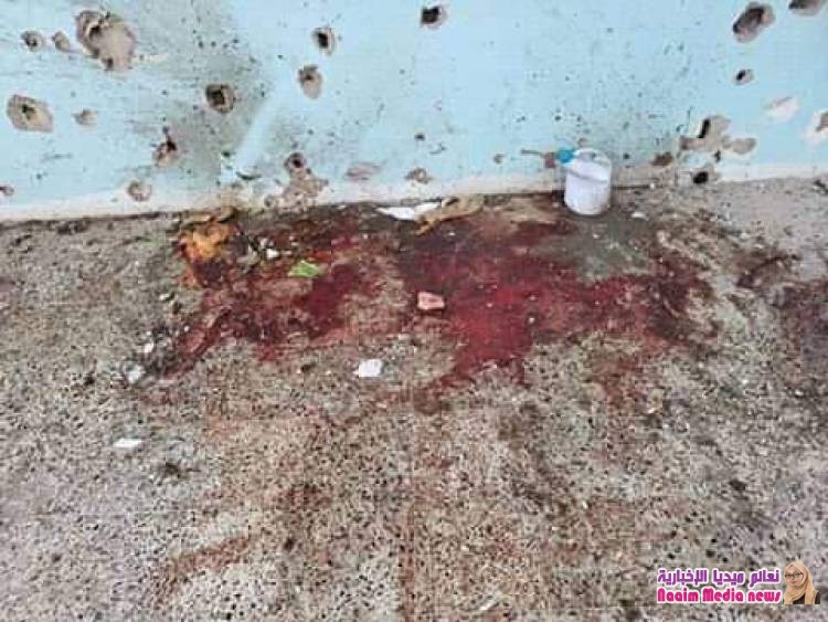 *قتلى وجرحى جراء مجزرة مروعة إرتكبتها المليشيات الحوثية بحق نزيلات السجن المركزي بتعز*