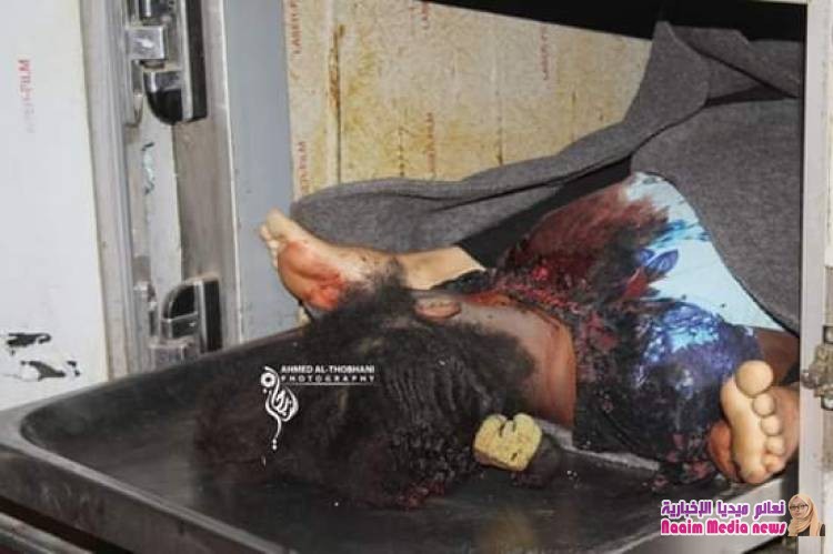 *قتلى وجرحى جراء مجزرة مروعة إرتكبتها المليشيات الحوثية بحق نزيلات السجن المركزي بتعز*