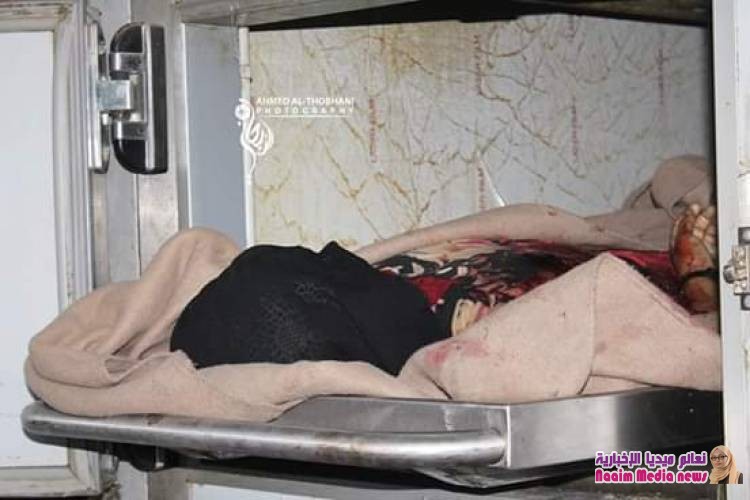 *قتلى وجرحى جراء مجزرة مروعة إرتكبتها المليشيات الحوثية بحق نزيلات السجن المركزي بتعز*