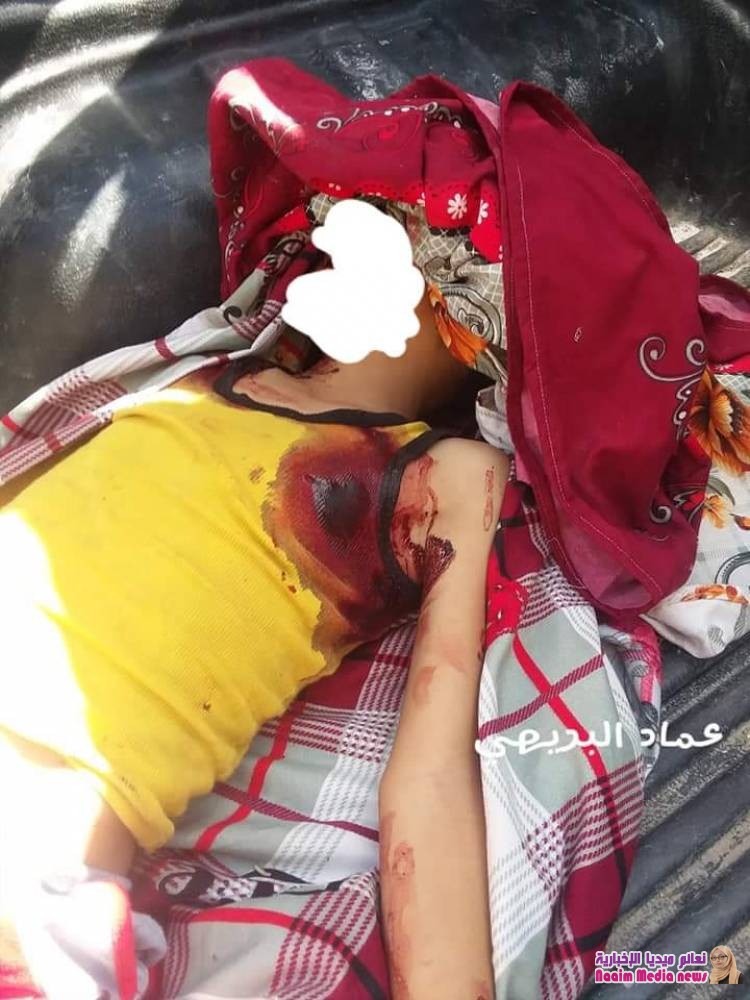اصابة طفلين بقناصة الحوثي بتعز