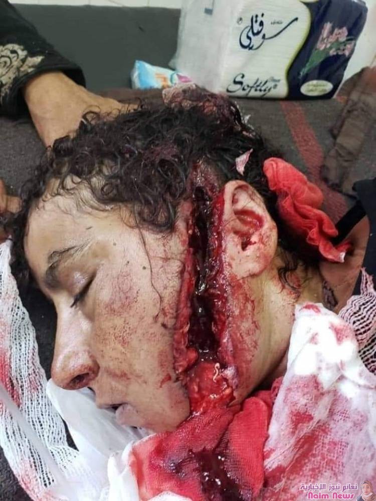 اصابة امراة بقناصة الحوثي بتعز