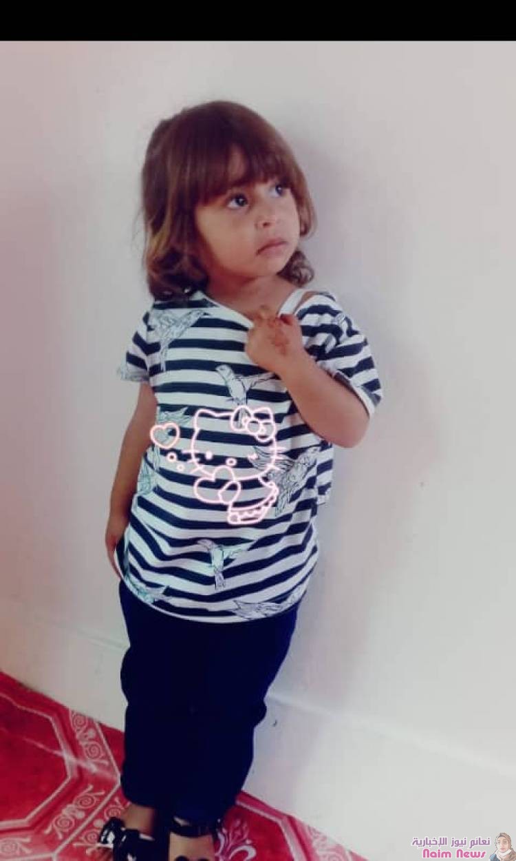 مناشدة انسانية عاجلة لاهل الخير والعطاء لانقاذ الطفلة سالي