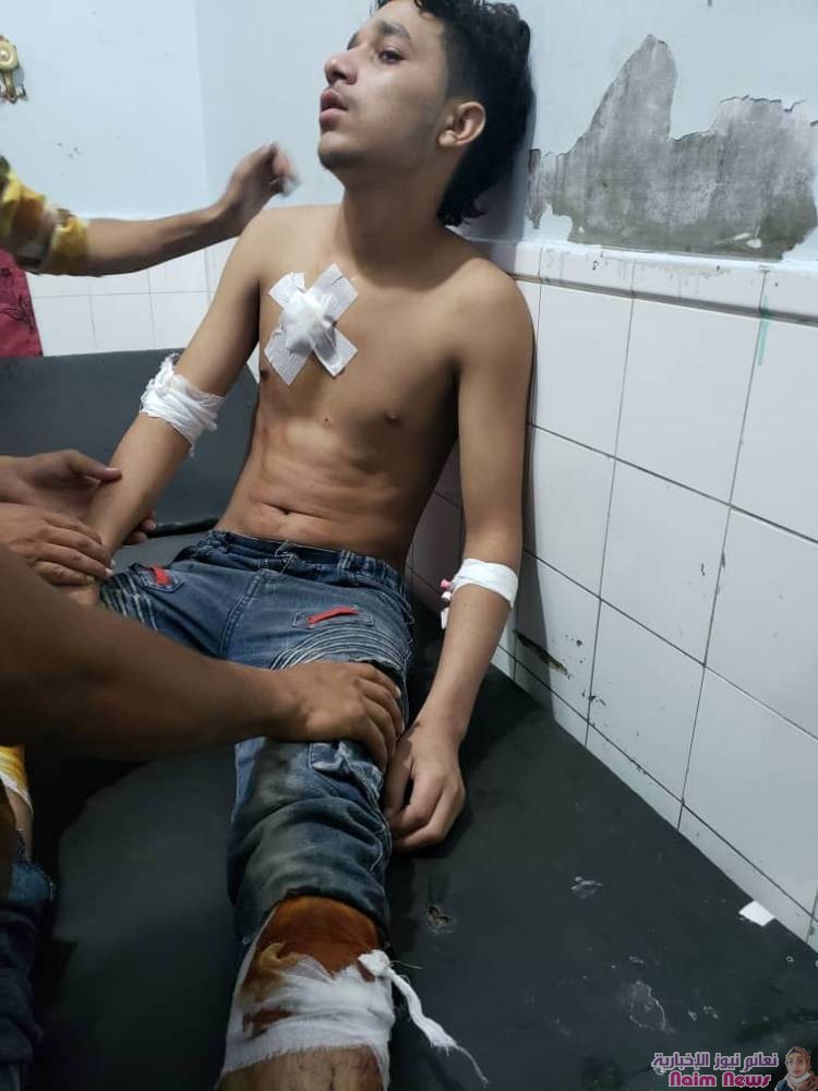 تعز : عاجل في إحصائية أولية إصابة 8 من المدنيين حالة بعضهم خطيرة جراء قصف مليشيا الحوثي الانقلابية لحي سوق الأشبط بمديرية صالة شرق مدينة تعز.