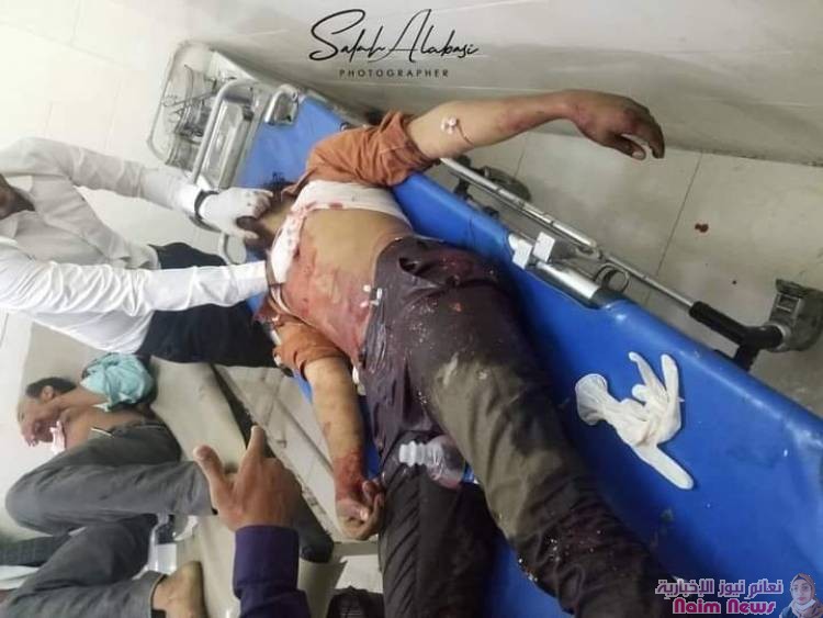 استشهاد شخصين من المدنيين وجرح آخرين جراء قصف عنيف منذ عصر اليوم تشنه ميلشيات الحوثي على الأحياء السكنية وسط مدينة تعز