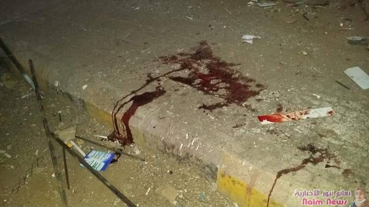 استشهاد شخصين من المدنيين وجرح آخرين جراء قصف عنيف منذ عصر اليوم تشنه ميلشيات الحوثي على الأحياء السكنية وسط مدينة تعز