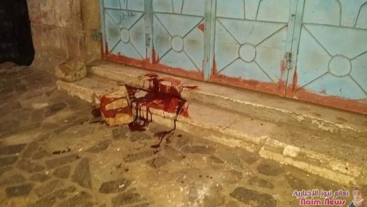 استشهاد شخصين من المدنيين وجرح آخرين جراء قصف عنيف منذ عصر اليوم تشنه ميلشيات الحوثي على الأحياء السكنية وسط مدينة تعز