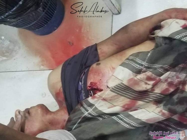 استشهاد شخصين من المدنيين وجرح آخرين جراء قصف عنيف منذ عصر اليوم تشنه ميلشيات الحوثي على الأحياء السكنية وسط مدينة تعز