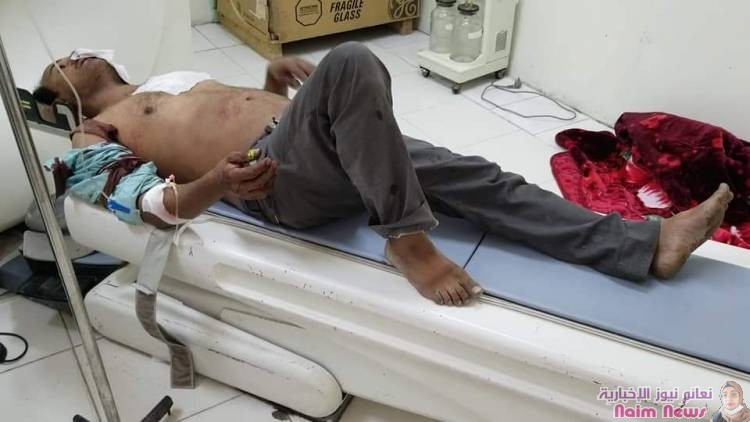 استشهاد شخصين من المدنيين وجرح آخرين جراء قصف عنيف منذ عصر اليوم تشنه ميلشيات الحوثي على الأحياء السكنية وسط مدينة تعز