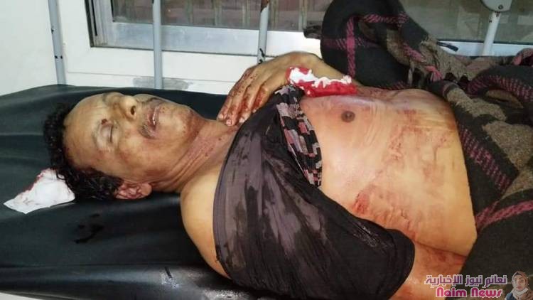 استشهاد شخصين من المدنيين وجرح آخرين جراء قصف عنيف منذ عصر اليوم تشنه ميلشيات الحوثي على الأحياء السكنية وسط مدينة تعز